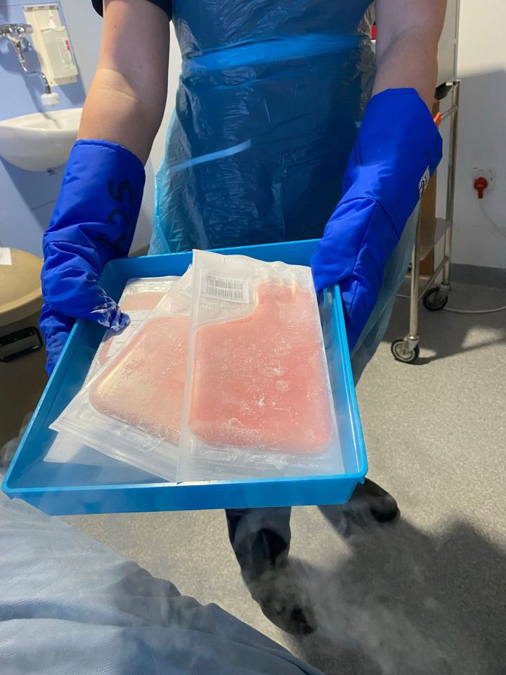 Person in blue gloves carrying a tray of frozen stem cells.