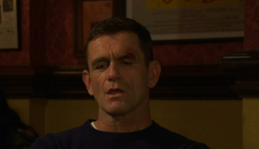 Screenshot of a man with a cut above his eye, sitting in a pub with two other people.