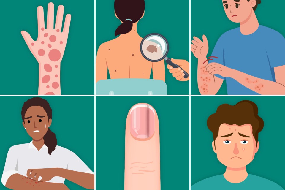 Illustrations of various skin conditions.