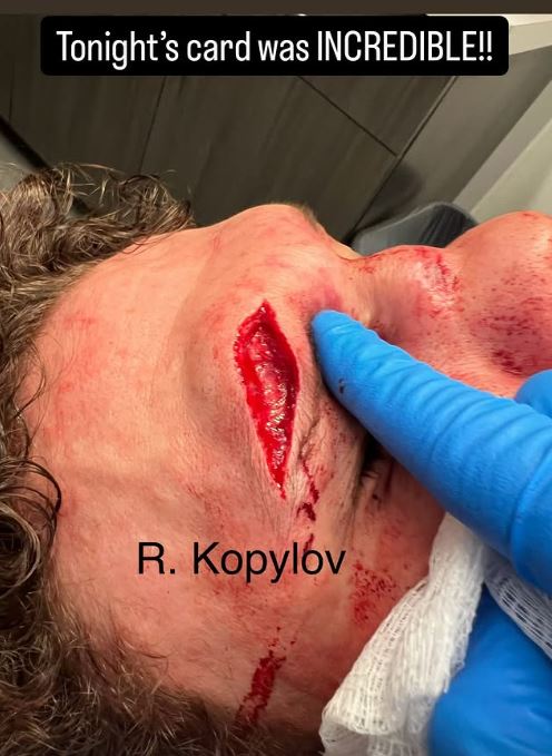 Close-up photo of a bloody cut on R. Kopylov's face.