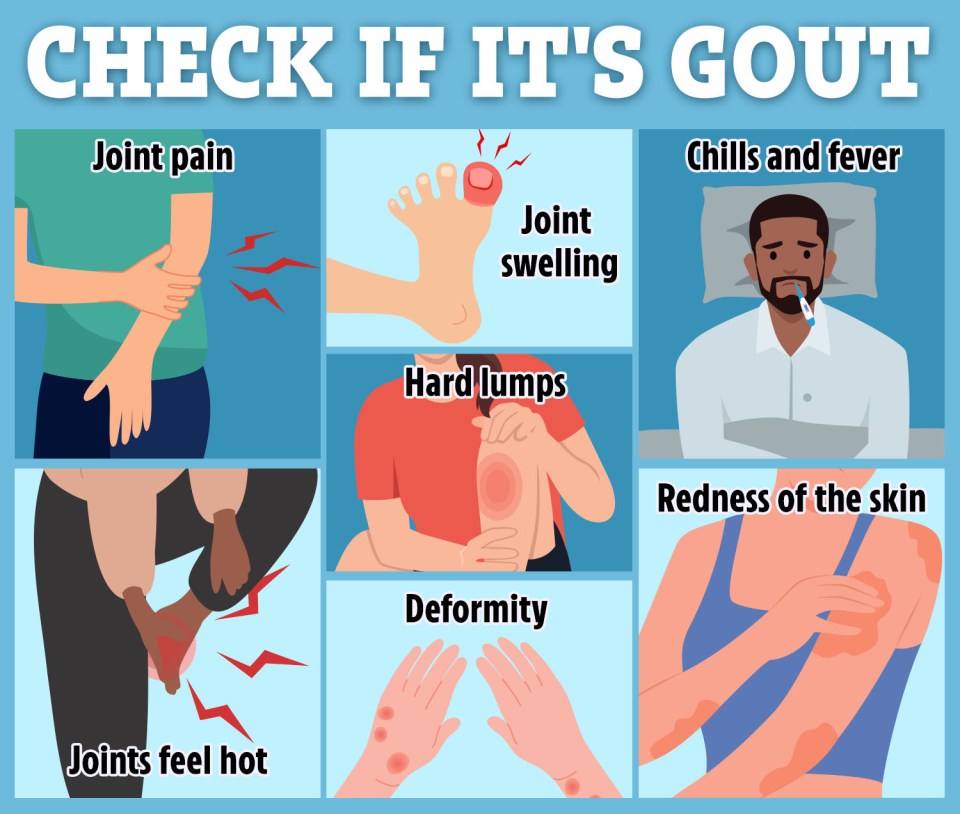 Illustration of gout symptoms: joint pain, swelling, redness, chills, fever, hard lumps, deformity, and hot joints.