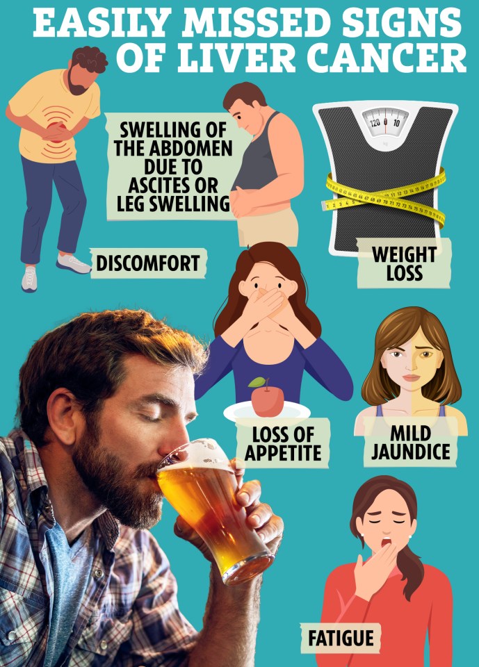 Illustration of easily missed liver cancer signs: abdominal swelling, discomfort, weight loss, loss of appetite, mild jaundice, and fatigue.