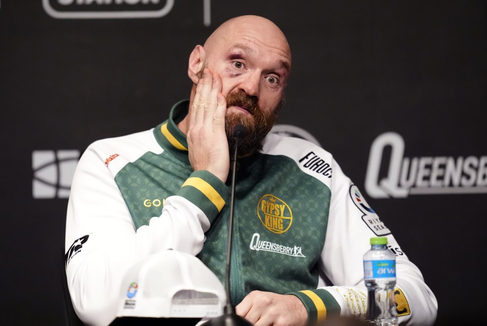 Tyson Fury at a press conference.