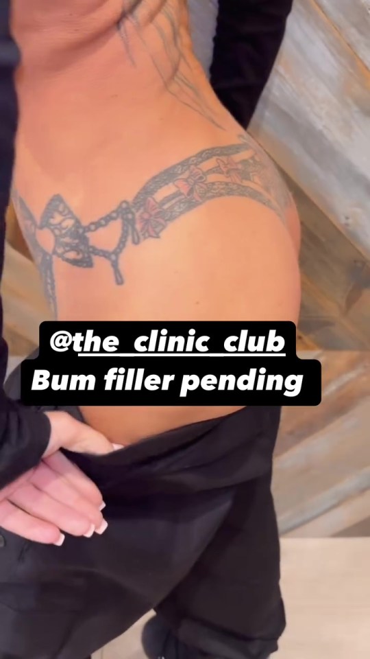 Woman's back with tattoo and text overlay: "Bum filler pending."