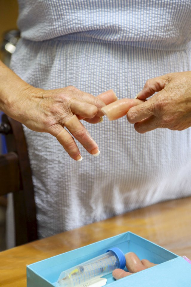 Woman putting on prosthetic fingers.