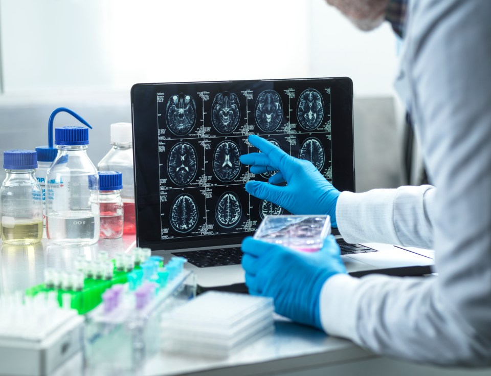 Scientist reviewing brain scans on a laptop.