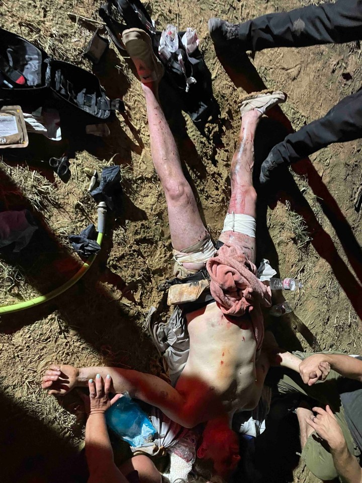 A severely injured man lying on the ground, receiving aid.