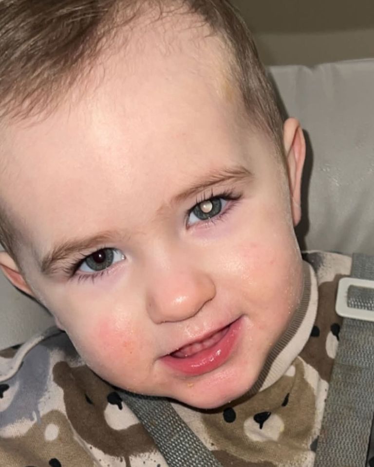 Taking photos with the flash on and seeing a white pupil is one of the signs of retinoblastoma